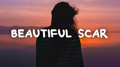 Beautiful Scar by Alicia Moffet